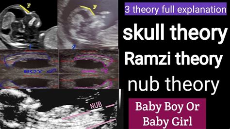 Boy Or Girl Baby Using Theory Skull Nub And Ramzi Theory Using Scan