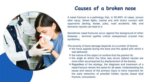 Ppt Fracture Nasal Bone Treatment Powerpoint Presentation Free