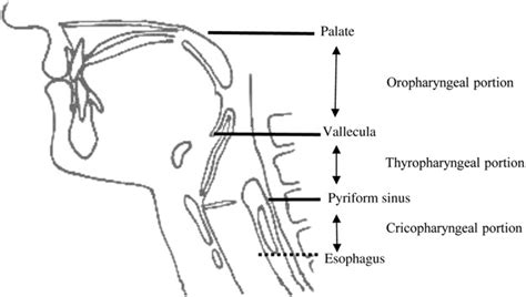 Anatomical Landmarks Used In The Assessment Of Bolus Passage