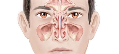 5 Quick Steps To Handle A Sudden Sinus Pain Neoalta Speciality Clinic