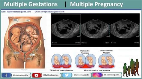 Multiple Gestations Lab Tests Guide