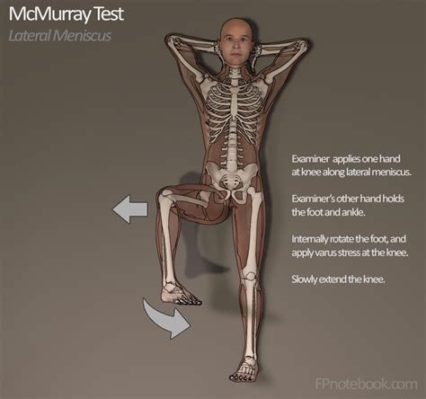 McMurray Test – Orthopedic Examination of the Knee