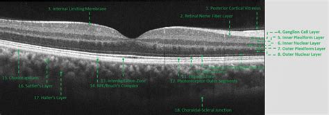 Healthy eye OCT - Lakeside Ophthalmology Center.