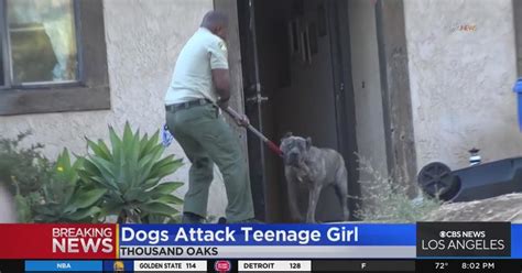 16 Year Old Girl Hospitalized After Being Attacked By Multiple Dogs