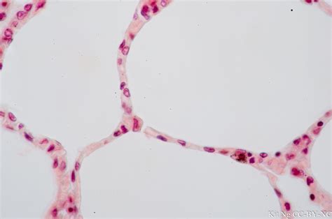 Simple Squamous Epithelium – Kit Ng, Ph.D.