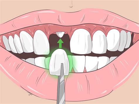 How to Remove Brown Stains from Teeth: 10 Proven Methods