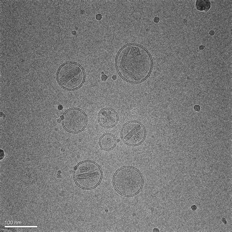 La Micrograf A Representa Nanopart Culas Hechas De L Pidos Que