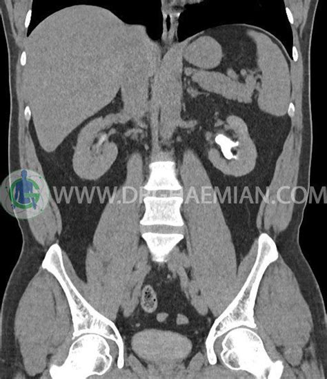 سی تی اسکن شکم و لگن چیست و چرا استفاده می شود؟ مرکز تصویربرداری دکتر