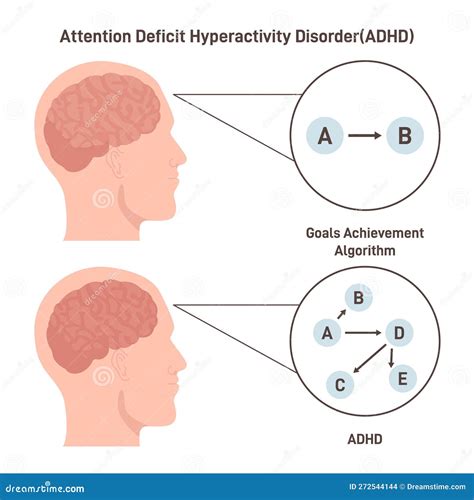 Adhd Brain Concept Attention Deficit Hyperactivity Disorder Way Stock