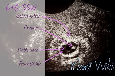 Dein Baby Im Ultraschall MamiWiki