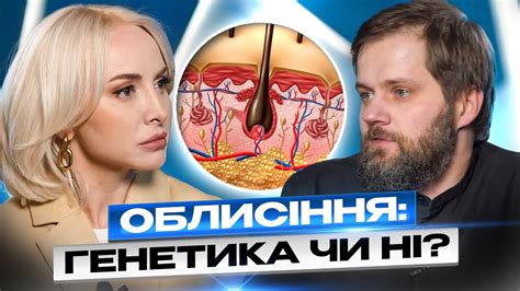 Ознаки облисіння на ранніх стадіях! Трихолог про випадіння волосся ...