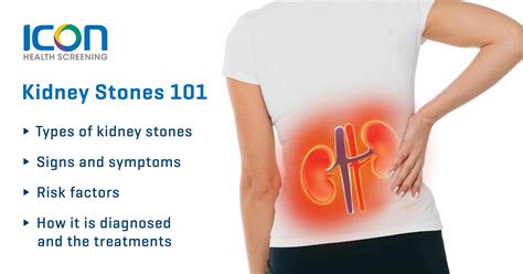 What causes kidney stones? — Icon Health Screening