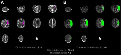 Ct Imaging Computed Tomographycomputed Tomography Angiography