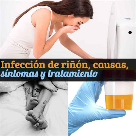 Infecci N De Ri N Causas S Ntomas Y Tratamiento La Gu A De Las