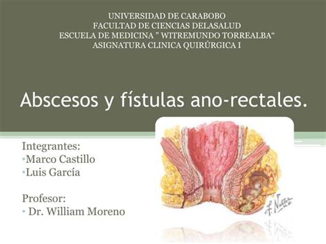 Abscesos y fístulas ano rectales PPT