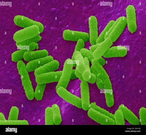 E Coli Bakterien Farbige Scanning Electron Micrograph Sem Von