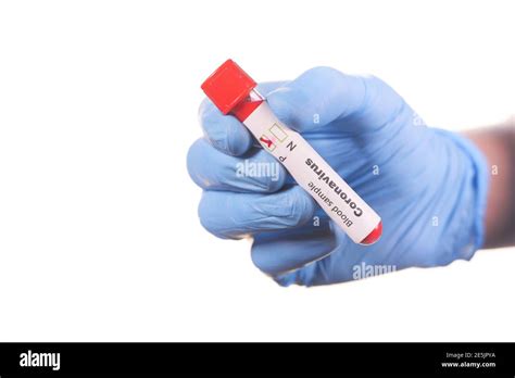 Hand In Blue Medical Gloves Holding Blood Test Tube Stock Photo Alamy