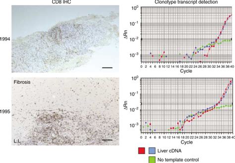 Tissue Homing And Persistence Of Defined Antigen Specific Cd8 Tumor