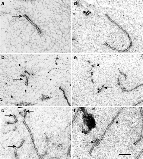 Synaptic Configurations Of B Chromosomes Silver Staining Arrows Download Scientific Diagram