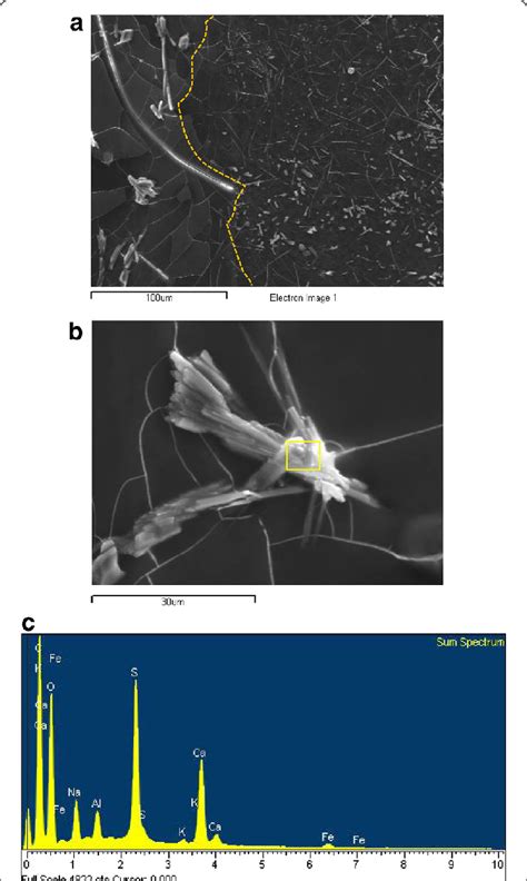 A Electron Micrograph With EDX Microanalysis Of A Parchment Sample