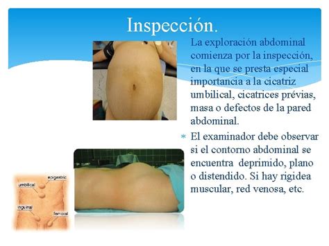 EL ABDOMEN ABDOMEN Es Una Cavidad Hermticamente Cerrada