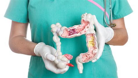 Advances in Colon Cancer Surgery