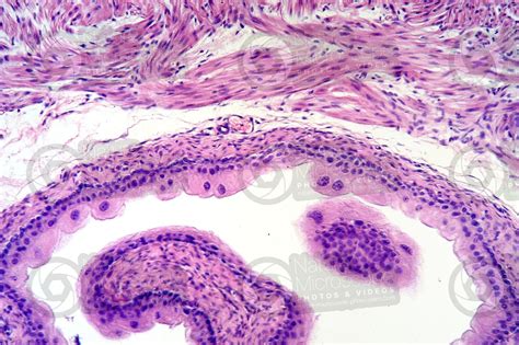 Rat Urinary Bladder Transverse Section 125x Rat Mammals