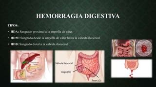 Hemorragia Alta Digestiva Pptx