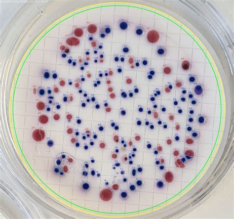 Identifying Bacteria in Petri Dishes