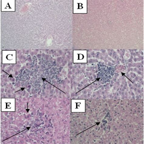 A And B Liver Micrographs Of Control And Tq Treated Groups