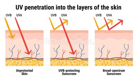 Penetración Uv En Las Capas De La Piel Infografía De La Protección De