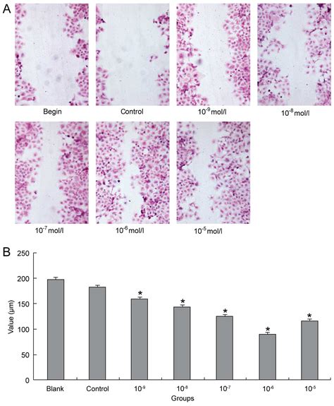 Corrigendum Estrogen Receptor Inhibits Estradiol Induced