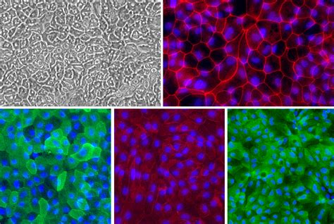 Human Colon Epithelial Cells Hcnepc Cell Applications