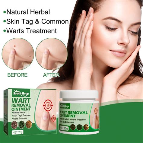 Wart Removing Cream Skin Wart Ointment Wart Removal Cream Skin Care