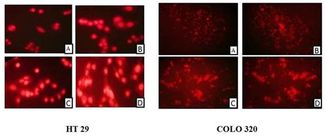 Nuclear morphological observation of HT 29 and COLO 320 cells treated ... 