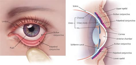 Pimple On Eyelid Types Causes And How To Treat Them