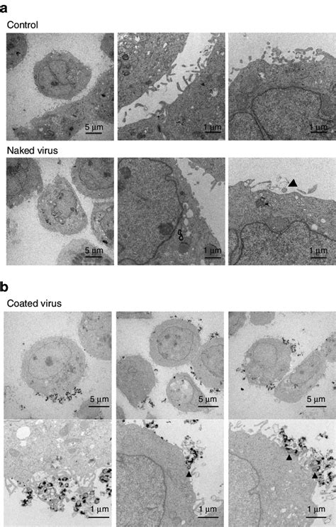 Electron Microscopic Images Of Human Cancer Cells After Viral