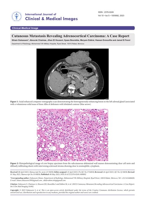 Pdf Clinical Medical Image Cutaneous Metastasis Revealing