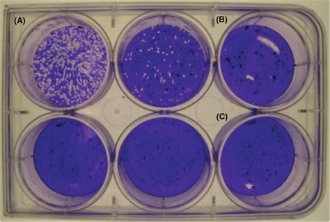 Two Detailed Plaque Assay Protocols For The Quantification Of