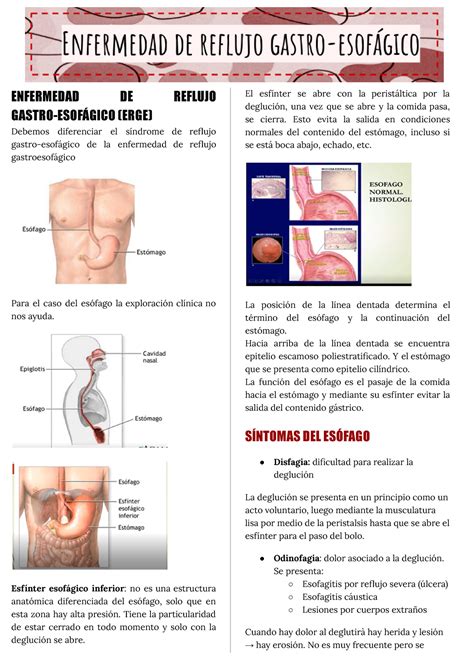 Enfermedad De Reflujo Gastroesof Gico Enfermedad De Reflujo Gastro