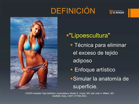 Lipoescultura De Alta Definici N Marcaci N Adbominal Ppt