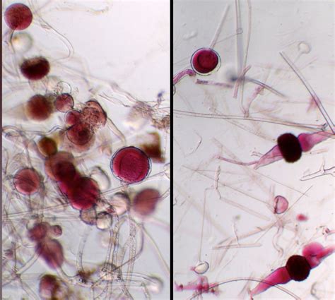 Rhizopus Sporangia And Zygotes Wm Microscope Slide Southern Biological