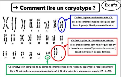 M Thode Comment Lire Un Caryotype Svt Coll Ge Condorcet