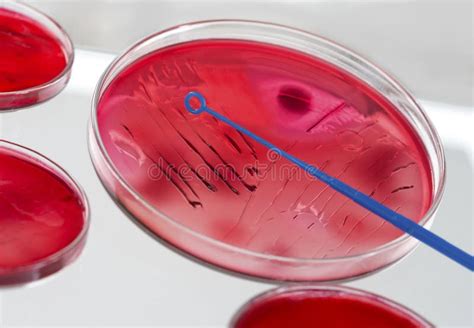 INOCULATION MICROBIOLOGY stock photo. Image of specimen - 46654326