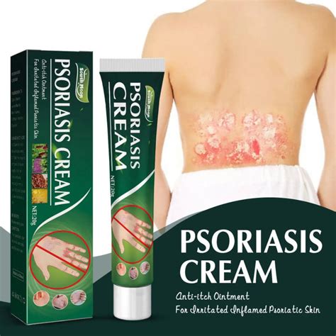 Herbal Skin Itching Antibacterial Cream Psoriasis Cream Treatment Urticaria Relief Cream