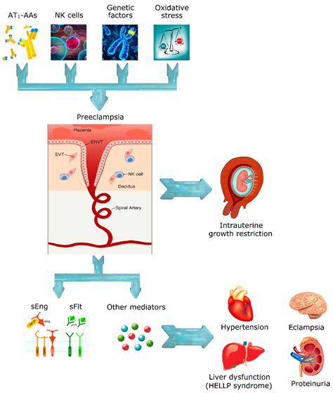 Eclampsia - AdilLeyland