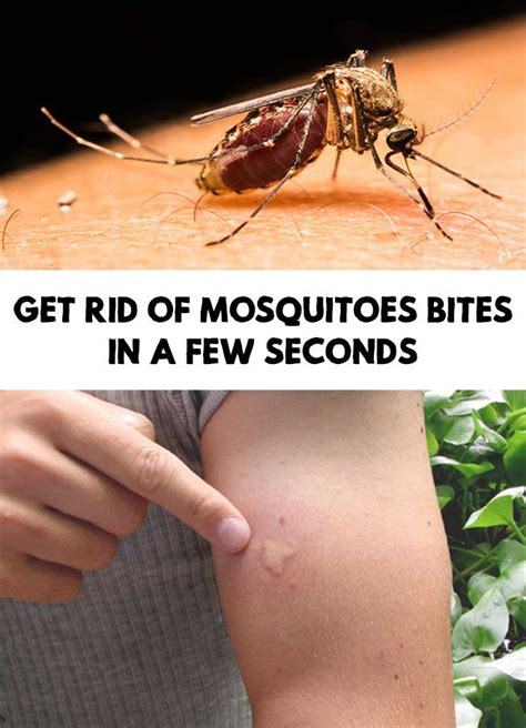 Get Rid Of Mosquitoes Bites In A Few Seconds Natural Remedies