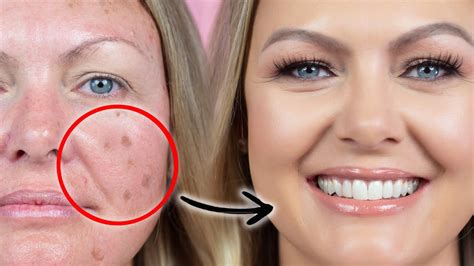 HOW TO COVER AGE SPOTS ACNE SCARS AND HYPER PIGMENTATION WITH MAKEUP