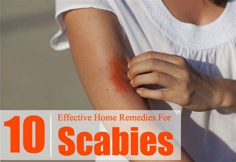 10 Effective Home Remedies For Scabies ~ Mzizi Mkavu