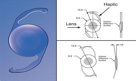 Presbyopia Correcting Intraocular Lenses And Corneal Refract Retina